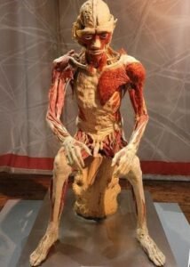 Αυτή είναι μια ιστορία που δύσκολα θα πίστευε κανείς… αν δεν είχε συμβεί πραγματικά. Ένα και μόνο λάθος στα έγγραφα ήταν αρκετό για να μετατρέψει τη ζωή μιας γυναίκας σε έναν εφιάλτη που ακόμη τη στοιχειώνει. Το 2014, ο 23χρονος Κρίστοφερ Τοντ Έρικ πέθανε κατά τη διάρκεια μιας ψυχωτικής κρίσης στην Αριζόνα. Η μητέρα του, Κιμ Σμιθ, ήταν δηλωμένη στα ιατρικά του αρχεία ως επαφή έκτακτης ανάγκης. Ωστόσο, μέσα στη γραφειοκρατία, σε μια μόνη γραμμή, έγινε ένα τραγικό λάθος: στα έγγραφα, ο Κρίστοφερ καταχωρήθηκε ως «άγνωστος» και «μη ανακτημένος». Εξαιτίας αυτού του λάθους, κανείς δεν κάλεσε την Κιμ. Κανείς δεν της είπε ότι ο γιος της είχε πεθάνει. Κανείς δεν της έδωσε την ευκαιρία να τον αποχαιρετήσει. Το σώμα του Κρίστοφερ στάλθηκε σε εργαστήριο, όπου ταριχεύτηκε, υποβλήθηκε σε χημική επεξεργασία και στη συνέχεια εντάχθηκε σε ένα έργο με τίτλο «Πραγματικά Σώματα» — μια διεθνή έκθεση που παρουσιάζει «πλαστικοποιημένα» ανθρώπινα σώματα για εκπαιδευτικούς σκοπούς. Πέρασαν χρόνια. Και μια μέρα, ενώ παρακολουθούσε τηλεόραση, η Κιμ έπεσε τυχαία πάνω σε ένα ρεπορτάζ για την έκθεση στο Λας Βέγκας. Η δημοσιογράφος μιλούσε για «ρεαλιστικές απεικονίσεις φτιαγμένες με ανθρώπινα σώματα». Η Κιμ κοίταξε αδιάφορα… μέχρι που είδε ένα από αυτά. Η φιγούρα, το πρόσωπο, η στάση… τον αναγνώρισε αμέσως. Ήταν ο γιος της. Ο κόσμος γύρω της φάνηκε να παγώνει. Μπροστά της δεν ήταν απλώς ένα έκθεμα, αλλά το παιδί που είχε γεννήσει, μεγαλώσει, αγαπήσει — και χάσει. Το παιδί που δεν είχε ποτέ την ευκαιρία να θάψει όπως του άξιζε. Αργότερα αποκαλύφθηκε ότι η σορός του Κρίστοφερ είχε καταλήξει στην έκθεση χωρίς τη συγκατάθεση της οικογένειας. Ο οργανισμός που ήταν υπεύθυνος για τις «εκπαιδευτικές παρουσιάσεις» ισχυρίστηκε ότι ενήργησε νόμιμα, καθώς η σορός είχε χαρακτηριστεί «μη ανακτημένη». Μα για την Κιμ, αυτό έμοιαζε με βάναυση κοροϊδία. Σήμερα αγωνίζεται όχι μόνο για δικαιοσύνη για τον γιο της, αλλά και για να αλλάξει το σύστημα. Ζητά να μην εκτεθεί ποτέ ξανά κανένα ανθρώπινο σώμα δημοσίως χωρίς τη ρητή άδεια της οικογένειας. Για εκείνη, αυτός ο αγώνας δεν είναι απλώς νομικός — είναι ένας τρόπος να αποκαταστήσει στον γιο της την αξιοπρέπεια που του στέρησε ένα γραφειοκρατικό λάθος. Η ιστορία έχει προκαλέσει έντονη παγκόσμια συζήτηση. Κάποιοι υποστηρίζουν ότι εκθέσεις όπως το «Real Bodies» συμβάλλουν στην κατανόηση της ανθρώπινης ανατομίας και στην εκτίμηση της ζωής. Άλλοι τις θεωρούν παραβίαση των ορίων, μια εισβολή σε ό,τι θα έπρεπε να παραμένει προσωπικό και ιερό. Όμως για την Κιμ Σμιθ, το θέμα είναι διαφορετικό. Δεν πρόκειται για επιστήμη ή φιλοσοφία. Πρόκειται για τον ανείπωτο πόνο μιας μητέρας που βρήκε τον γιο της εκεί που κανείς δεν θα έπρεπε ποτέ να τον αντικρίσει.