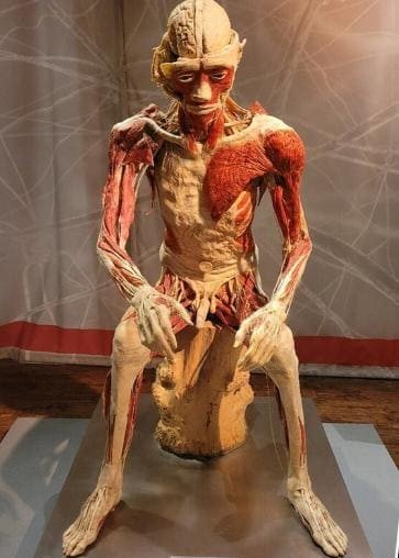 Αυτή είναι μια ιστορία που δύσκολα θα πίστευε κανείς… αν δεν είχε συμβεί πραγματικά. Ένα και μόνο λάθος στα έγγραφα ήταν αρκετό για να μετατρέψει τη ζωή μιας γυναίκας σε έναν εφιάλτη που ακόμη τη στοιχειώνει. Το 2014, ο 23χρονος Κρίστοφερ Τοντ Έρικ πέθανε κατά τη διάρκεια μιας ψυχωτικής κρίσης στην Αριζόνα. Η μητέρα του, Κιμ Σμιθ, ήταν δηλωμένη στα ιατρικά του αρχεία ως επαφή έκτακτης ανάγκης. Ωστόσο, μέσα στη γραφειοκρατία, σε μια μόνη γραμμή, έγινε ένα τραγικό λάθος: στα έγγραφα, ο Κρίστοφερ καταχωρήθηκε ως «άγνωστος» και «μη ανακτημένος». Εξαιτίας αυτού του λάθους, κανείς δεν κάλεσε την Κιμ. Κανείς δεν της είπε ότι ο γιος της είχε πεθάνει. Κανείς δεν της έδωσε την ευκαιρία να τον αποχαιρετήσει. Το σώμα του Κρίστοφερ στάλθηκε σε εργαστήριο, όπου ταριχεύτηκε, υποβλήθηκε σε χημική επεξεργασία και στη συνέχεια εντάχθηκε σε ένα έργο με τίτλο «Πραγματικά Σώματα» — μια διεθνή έκθεση που παρουσιάζει «πλαστικοποιημένα» ανθρώπινα σώματα για εκπαιδευτικούς σκοπούς. Πέρασαν χρόνια. Και μια μέρα, ενώ παρακολουθούσε τηλεόραση, η Κιμ έπεσε τυχαία πάνω σε ένα ρεπορτάζ για την έκθεση στο Λας Βέγκας. Η δημοσιογράφος μιλούσε για «ρεαλιστικές απεικονίσεις φτιαγμένες με ανθρώπινα σώματα». Η Κιμ κοίταξε αδιάφορα… μέχρι που είδε ένα από αυτά. Η φιγούρα, το πρόσωπο, η στάση… τον αναγνώρισε αμέσως. Ήταν ο γιος της. Ο κόσμος γύρω της φάνηκε να παγώνει. Μπροστά της δεν ήταν απλώς ένα έκθεμα, αλλά το παιδί που είχε γεννήσει, μεγαλώσει, αγαπήσει — και χάσει. Το παιδί που δεν είχε ποτέ την ευκαιρία να θάψει όπως του άξιζε. Αργότερα αποκαλύφθηκε ότι η σορός του Κρίστοφερ είχε καταλήξει στην έκθεση χωρίς τη συγκατάθεση της οικογένειας. Ο οργανισμός που ήταν υπεύθυνος για τις «εκπαιδευτικές παρουσιάσεις» ισχυρίστηκε ότι ενήργησε νόμιμα, καθώς η σορός είχε χαρακτηριστεί «μη ανακτημένη». Μα για την Κιμ, αυτό έμοιαζε με βάναυση κοροϊδία. Σήμερα αγωνίζεται όχι μόνο για δικαιοσύνη για τον γιο της, αλλά και για να αλλάξει το σύστημα. Ζητά να μην εκτεθεί ποτέ ξανά κανένα ανθρώπινο σώμα δημοσίως χωρίς τη ρητή άδεια της οικογένειας. Για εκείνη, αυτός ο αγώνας δεν είναι απλώς νομικός — είναι ένας τρόπος να αποκαταστήσει στον γιο της την αξιοπρέπεια που του στέρησε ένα γραφειοκρατικό λάθος. Η ιστορία έχει προκαλέσει έντονη παγκόσμια συζήτηση. Κάποιοι υποστηρίζουν ότι εκθέσεις όπως το «Real Bodies» συμβάλλουν στην κατανόηση της ανθρώπινης ανατομίας και στην εκτίμηση της ζωής. Άλλοι τις θεωρούν παραβίαση των ορίων, μια εισβολή σε ό,τι θα έπρεπε να παραμένει προσωπικό και ιερό. Όμως για την Κιμ Σμιθ, το θέμα είναι διαφορετικό. Δεν πρόκειται για επιστήμη ή φιλοσοφία. Πρόκειται για τον ανείπωτο πόνο μιας μητέρας που βρήκε τον γιο της εκεί που κανείς δεν θα έπρεπε ποτέ να τον αντικρίσει.